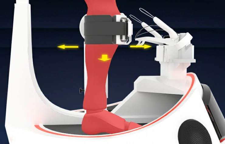 Leg Control